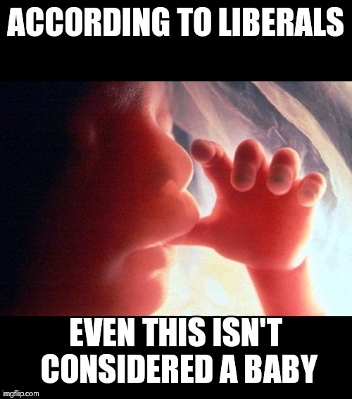 Abortion | ACCORDING TO LIBERALS EVEN THIS ISN'T CONSIDERED A BABY | image tagged in abortion | made w/ Imgflip meme maker