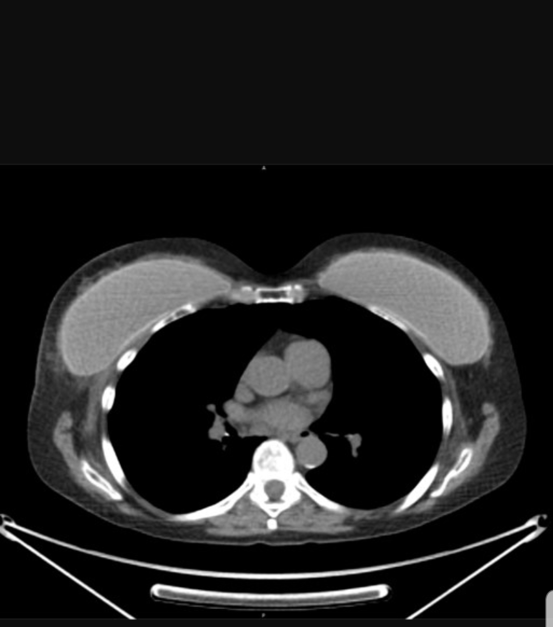 High Quality Implants Blank Meme Template