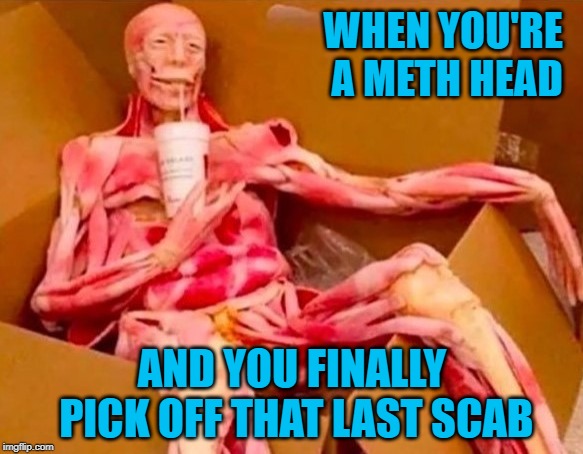 Aaaaaaahhhhh.... | WHEN YOU'RE A METH HEAD; AND YOU FINALLY PICK OFF THAT LAST SCAB | image tagged in skinless,memes,methheads,funny,picking scabs,no worries | made w/ Imgflip meme maker