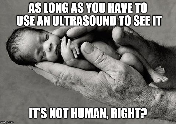 PLANNED PARENTHOOD STOP | AS LONG AS YOU HAVE TO USE AN ULTRASOUND TO SEE IT; IT'S NOT HUMAN, RIGHT? | image tagged in planned parenthood stop | made w/ Imgflip meme maker