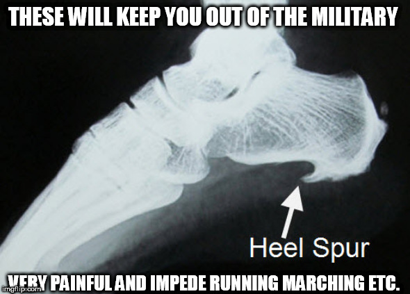 Bone spur | THESE WILL KEEP YOU OUT OF THE MILITARY; VERY PAINFUL AND IMPEDE RUNNING MARCHING ETC. | image tagged in bone spur | made w/ Imgflip meme maker