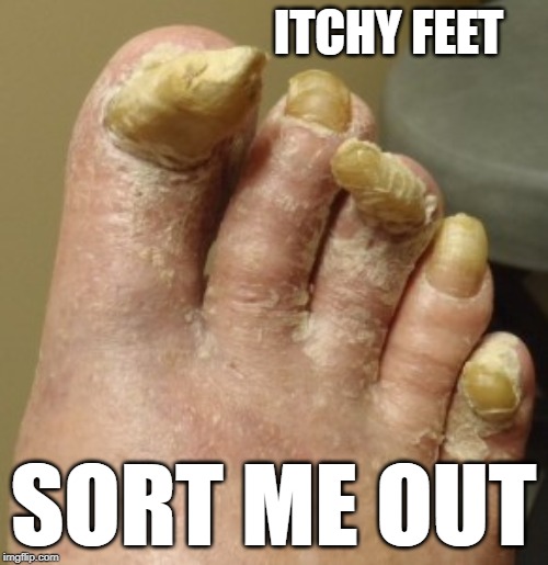 ITCHY FEET SORT ME OUT | made w/ Imgflip meme maker