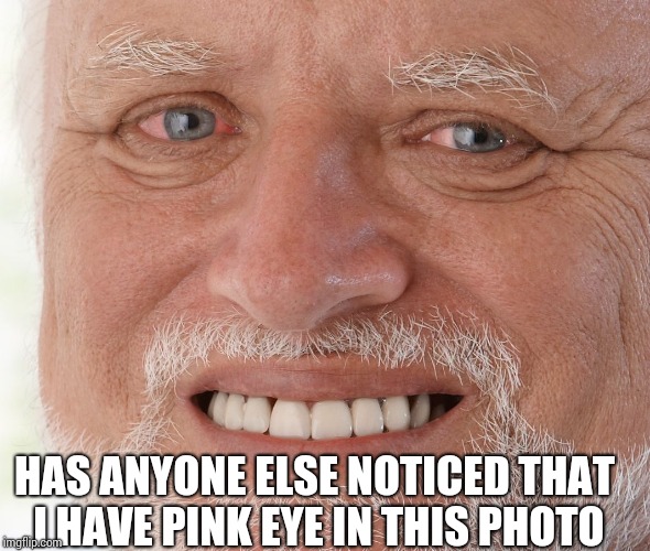 Hide the Pain Harold | HAS ANYONE ELSE NOTICED THAT I HAVE PINK EYE IN THIS PHOTO | image tagged in hide the pain harold | made w/ Imgflip meme maker