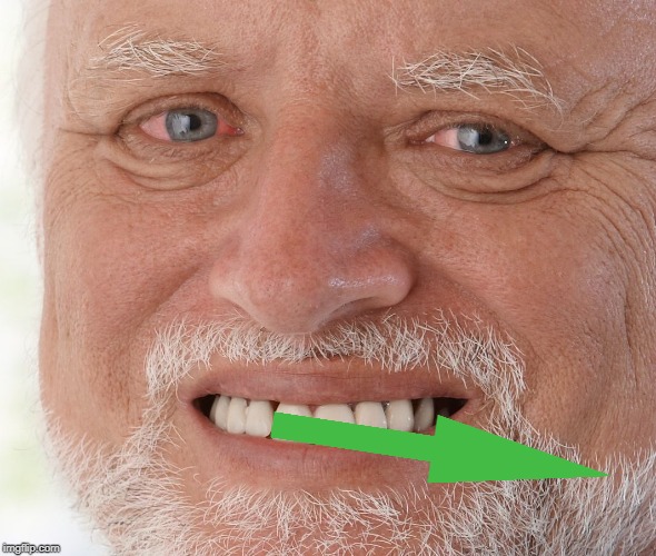 Hide the Pain Harold | image tagged in hide the pain harold | made w/ Imgflip meme maker