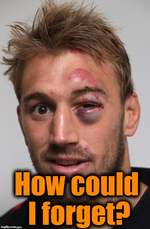 black eye | How could I forget? | image tagged in black eye | made w/ Imgflip meme maker