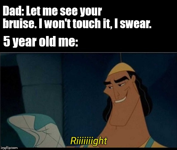 Kronk riiight with spacing | Dad: Let me see your bruise. I won't touch it, I swear. 5 year old me: | image tagged in kronk riiight with spacing | made w/ Imgflip meme maker