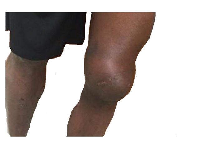 Knee Grow Blank Meme Template