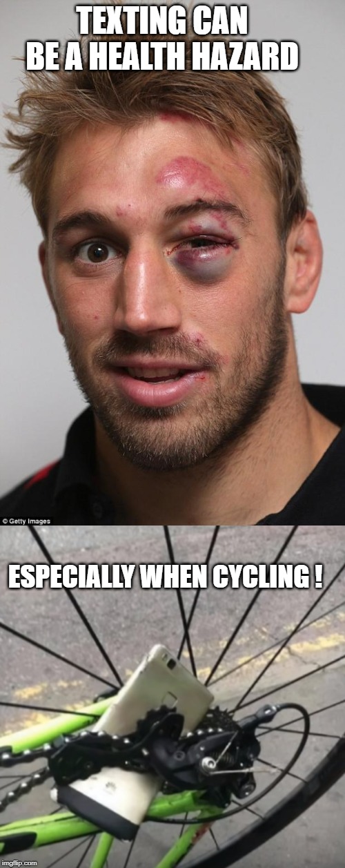 the pothole didn't help ! | TEXTING CAN BE A HEALTH HAZARD; ESPECIALLY WHEN CYCLING ! | image tagged in black eye,cycle,phone | made w/ Imgflip meme maker