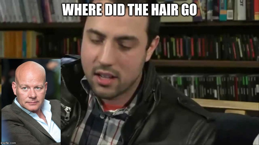 Where Did The Hair Go | WHERE DID THE HAIR GO | image tagged in where did the hair go,blachman | made w/ Imgflip meme maker