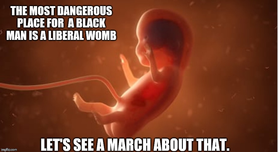 Fetus | THE MOST DANGEROUS PLACE FOR  A BLACK MAN IS A LIBERAL WOMB; LET'S SEE A MARCH ABOUT THAT. | image tagged in fetus | made w/ Imgflip meme maker