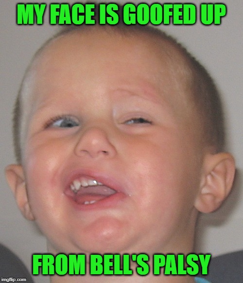 MY FACE IS GOOFED UP FROM BELL'S PALSY | made w/ Imgflip meme maker