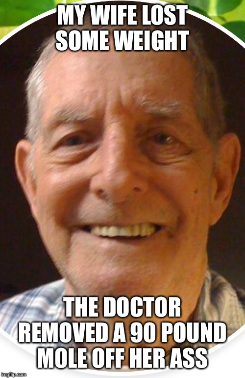 Old man from the Internet | MY WIFE LOST SOME WEIGHT; THE DOCTOR REMOVED A 90 POUND MOLE OFF HER ASS | image tagged in old man from the internet | made w/ Imgflip meme maker