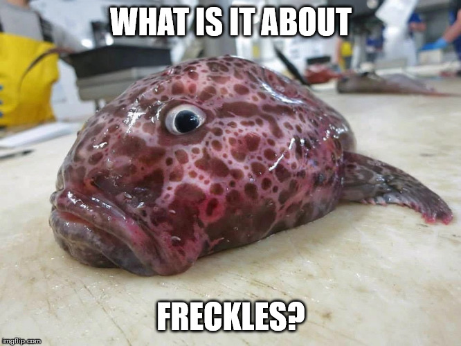Freckles | WHAT IS IT ABOUT; FRECKLES? | image tagged in spots,unlucky ginger kid | made w/ Imgflip meme maker