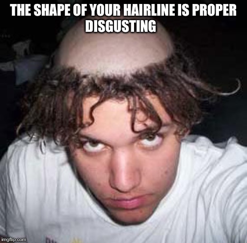 bad haircut | THE SHAPE OF YOUR HAIRLINE IS PROPER
DISGUSTING | image tagged in bad haircut | made w/ Imgflip meme maker