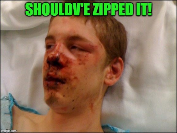 beat up guy | SHOULDV'E ZIPPED IT! | image tagged in beat up guy | made w/ Imgflip meme maker