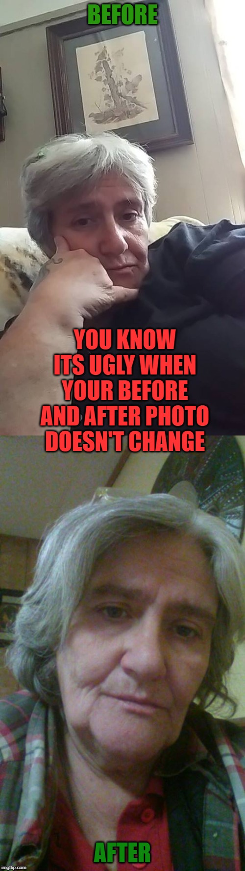 Before and After | BEFORE; YOU KNOW ITS UGLY WHEN YOUR BEFORE AND AFTER PHOTO DOESN'T CHANGE; AFTER | image tagged in funny memes,crack head,meth head | made w/ Imgflip meme maker