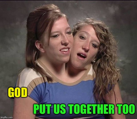 Conjoined twins | GOD PUT US TOGETHER TOO | image tagged in conjoined twins | made w/ Imgflip meme maker