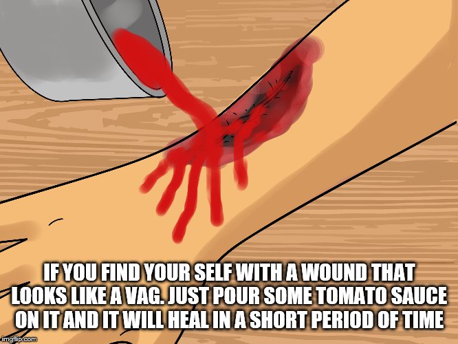 IF YOU FIND YOUR SELF WITH A WOUND THAT LOOKS LIKE A VAG. JUST POUR SOME TOMATO SAUCE ON IT AND IT WILL HEAL IN A SHORT PERIOD OF TIME | image tagged in drs advice | made w/ Imgflip meme maker