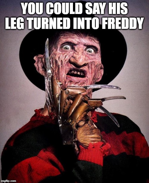 Freddy Krueger face | YOU COULD SAY HIS LEG TURNED INTO FREDDY | image tagged in freddy krueger face | made w/ Imgflip meme maker