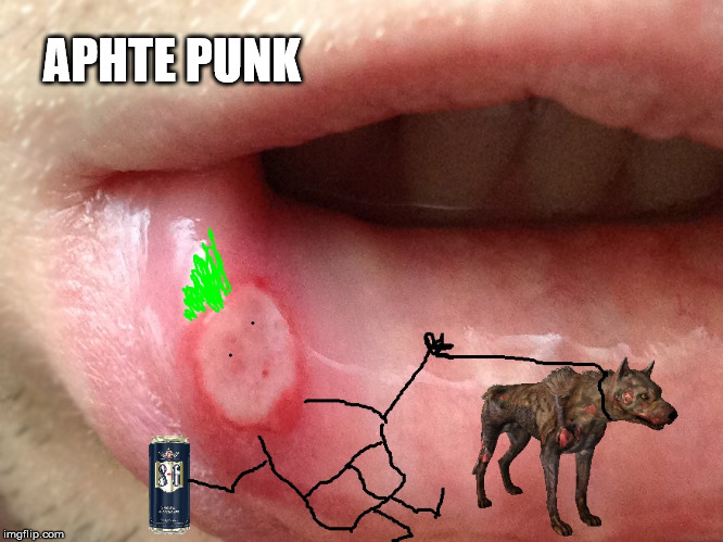 Aphte Punk |  APHTE PUNK | image tagged in aphte,punk,daft,harderbetterfasterstronger | made w/ Imgflip meme maker