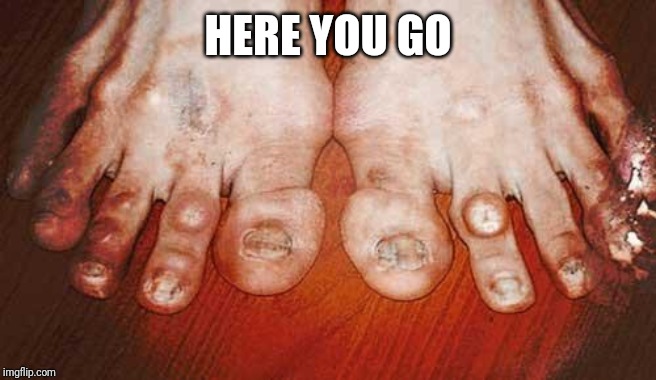 Ugly Feet | HERE YOU GO | image tagged in ugly feet | made w/ Imgflip meme maker