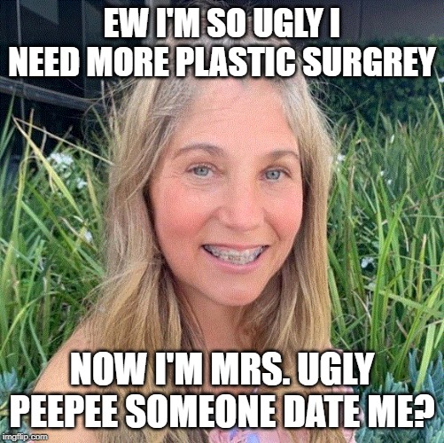 EW I'M SO UGLY I NEED MORE PLASTIC SURGREY; NOW I'M MRS. UGLY PEEPEE SOMEONE DATE ME? | made w/ Imgflip meme maker