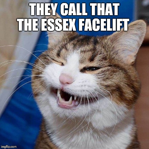 THEY CALL THAT THE ESSEX FACELIFT | made w/ Imgflip meme maker