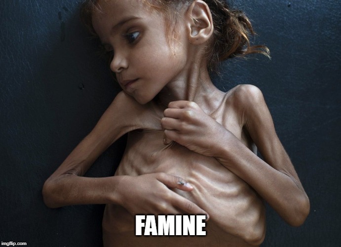 Yemeni Famine | FAMINE | image tagged in yemeni famine | made w/ Imgflip meme maker