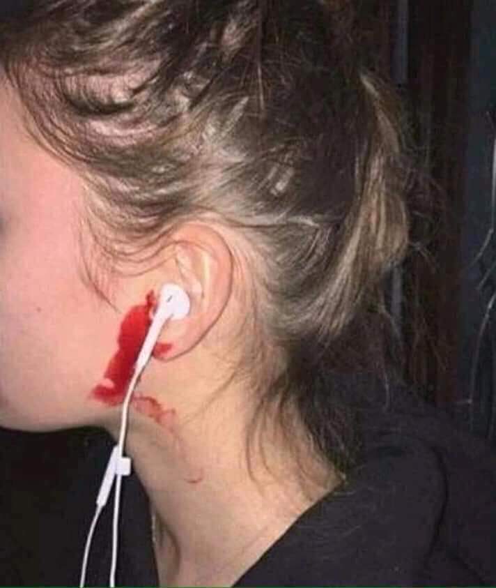 Ear Bleed Blank Meme Template