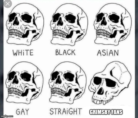 White Black Asian Gay Straight skull template | GRIMSBY FANS | image tagged in white black asian gay straight skull template | made w/ Imgflip meme maker