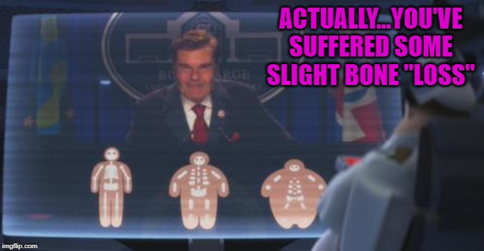 ACTUALLY...YOU'VE SUFFERED SOME SLIGHT BONE "LOSS" | made w/ Imgflip meme maker