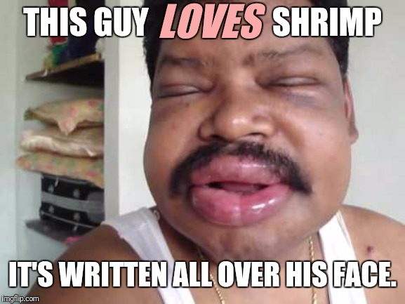 If this happens when you eat it, it's not food. | THIS GUY                    SHRIMP IT'S WRITTEN ALL OVER HIS FACE. LOVES | image tagged in seafood,allergies,shrimp | made w/ Imgflip meme maker