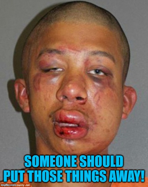 beat up guy | SOMEONE SHOULD PUT THOSE THINGS AWAY! | image tagged in beat up guy | made w/ Imgflip meme maker