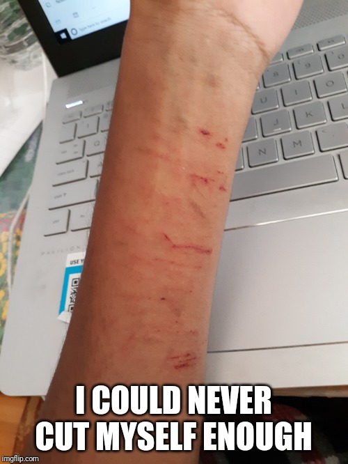 Loser | I COULD NEVER CUT MYSELF ENOUGH | image tagged in loser filth | made w/ Imgflip meme maker