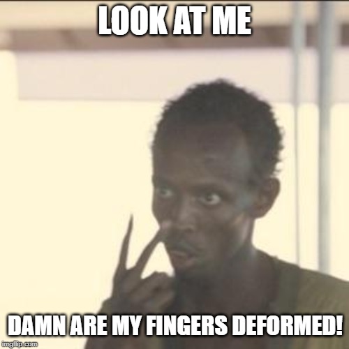 Bet You Never Noticed...... | LOOK AT ME; DAMN ARE MY FINGERS DEFORMED! | image tagged in memes,look at me | made w/ Imgflip meme maker