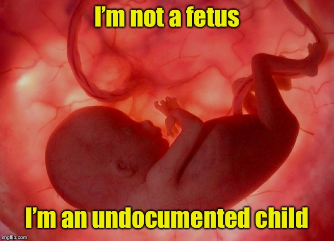 Politically Correct Pro Life Message for Liberals | I’m not a fetus; I’m an undocumented child | image tagged in fetus,liberal logic,abortion is murder,pro life | made w/ Imgflip meme maker