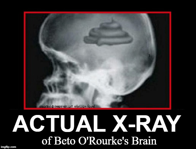 I am embarassed that Beto is from Texas | ACTUAL X-RAY of Beto O'Rourke's Brain | image tagged in vince vance,xray,shithead,beto,rober francis o'rourke,brain | made w/ Imgflip meme maker