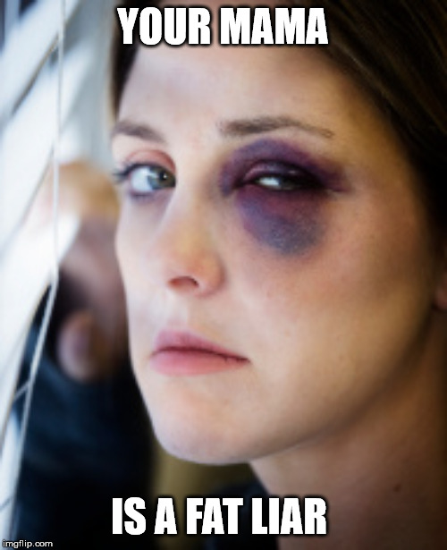 black eye | YOUR MAMA IS A FAT LIAR | image tagged in black eye | made w/ Imgflip meme maker