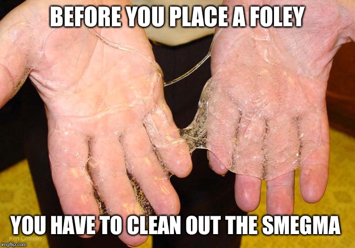 Sticky hands | BEFORE YOU PLACE A FOLEY; YOU HAVE TO CLEAN OUT THE SMEGMA | image tagged in sticky hands | made w/ Imgflip meme maker