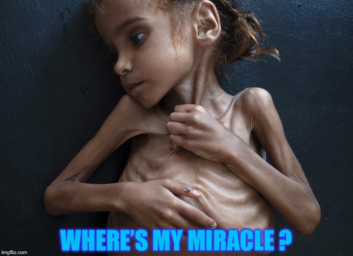 Yemeni Famine | WHERE’S MY MIRACLE ? | image tagged in yemeni famine | made w/ Imgflip meme maker