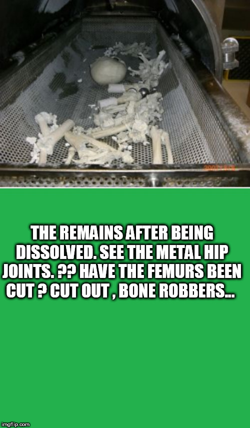 THE REMAINS AFTER BEING DISSOLVED. SEE THE METAL HIP JOINTS. ?? HAVE THE FEMURS BEEN CUT ? CUT OUT , BONE ROBBERS... | image tagged in green screen,quest 2 no | made w/ Imgflip meme maker