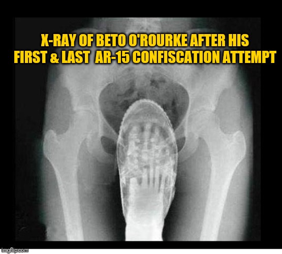 Beto O'Rourke | X-RAY OF BETO O'ROURKE AFTER HIS FIRST & LAST  AR-15 CONFISCATION ATTEMPT | image tagged in beto o'rourke | made w/ Imgflip meme maker