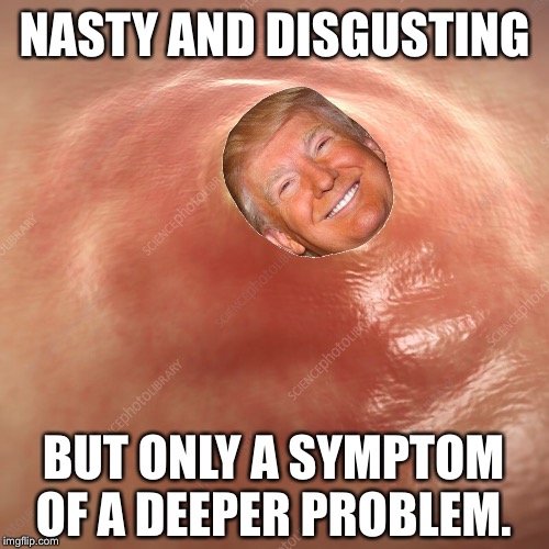 Dermatologist wanted. | NASTY AND DISGUSTING; BUT ONLY A SYMPTOM OF A DEEPER PROBLEM. | image tagged in pop culture,american horror story,grossed out,america needs soap | made w/ Imgflip meme maker