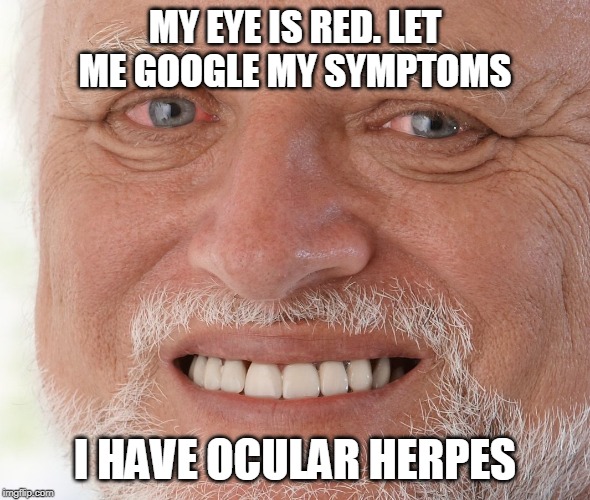 Hide the Pain Harold | MY EYE IS RED. LET ME GOOGLE MY SYMPTOMS; I HAVE OCULAR HERPES | image tagged in hide the pain harold | made w/ Imgflip meme maker