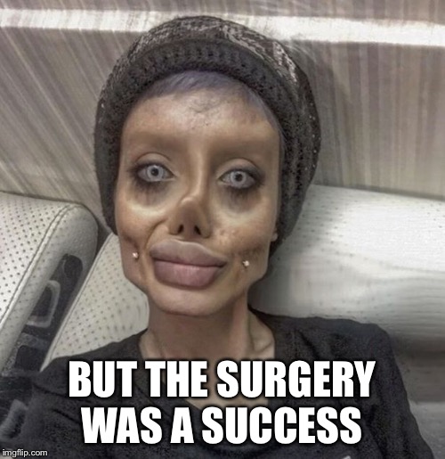 plastic surgery | BUT THE SURGERY WAS A SUCCESS | image tagged in plastic surgery | made w/ Imgflip meme maker