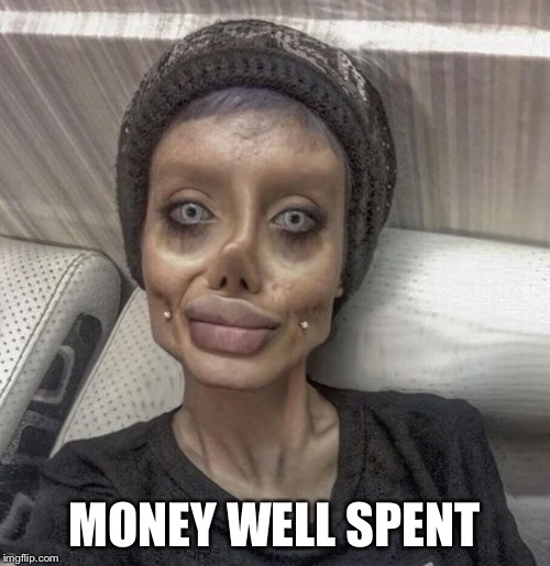 plastic surgery | MONEY WELL SPENT | image tagged in plastic surgery | made w/ Imgflip meme maker