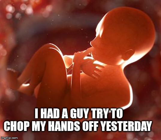 thinking fetus | I HAD A GUY TRY TO CHOP MY HANDS OFF YESTERDAY | image tagged in thinking fetus | made w/ Imgflip meme maker