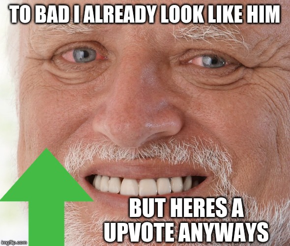 Hide the Pain Harold | TO BAD I ALREADY LOOK LIKE HIM BUT HERES A UPVOTE ANYWAYS | image tagged in hide the pain harold | made w/ Imgflip meme maker