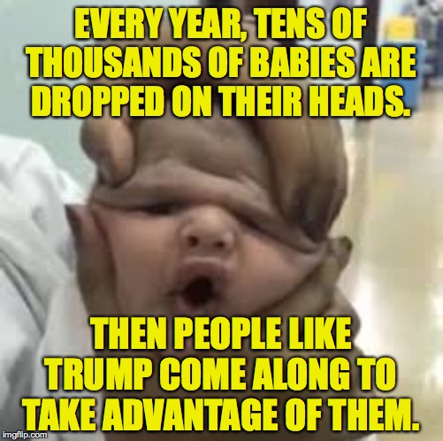 EVERY YEAR, TENS OF THOUSANDS OF BABIES ARE
DROPPED ON THEIR HEADS. THEN PEOPLE LIKE TRUMP COME ALONG TO TAKE ADVANTAGE OF THEM. | made w/ Imgflip meme maker