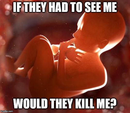 Thinking fetus thinks they would be cowards | IF THEY HAD TO SEE ME; WOULD THEY KILL ME? | image tagged in thinking fetus,memes,politics | made w/ Imgflip meme maker